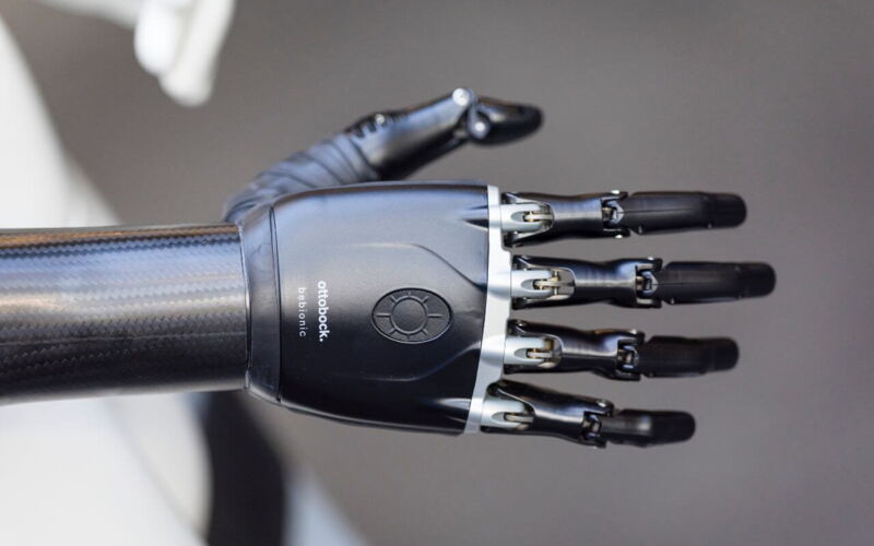 Prostheses at the Global Disability Summit 2025